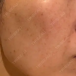 ルラ美容クリニック ルラ美容クリニック 広島院口コミ