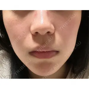 ルラ美容クリニック ルラ美容クリニック 札幌本院口コミ