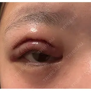 BIANCA CLINIC BIANCA銀座口コミ