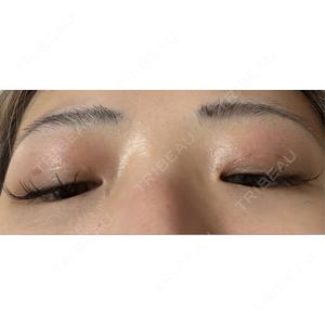 BITO BEAUTY CLINIC BITO BEAUTY CLINIC口コミ