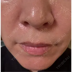 NARU Beauty Clinic NARU Beauty Clinic 【ナルクリ】 水戸院口コミ