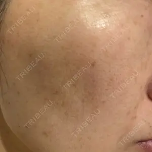 ルラ美容クリニック ルラ美容クリニック 広島院口コミ