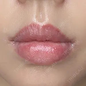 ルーチェクリニック ルーチェクリニック 銀座院口コミ