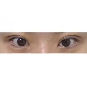 東京ココセランクリニック口コミ