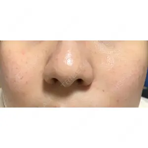 ゆきスキンクリニック 東池袋口コミ