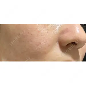 ゆきスキンクリニック 東池袋口コミ