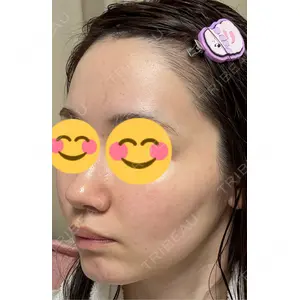 Belle Via Skin Clinic Belle Via Clinic口コミ