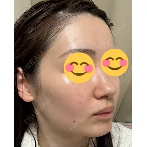 Belle Via Skin Clinic Belle Via Clinic口コミ