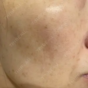 ルラ美容クリニック ルラ美容クリニック 広島院口コミ