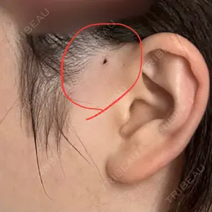 BON BON CLINIC BON BON CLINIC 銀座駅前本院口コミ