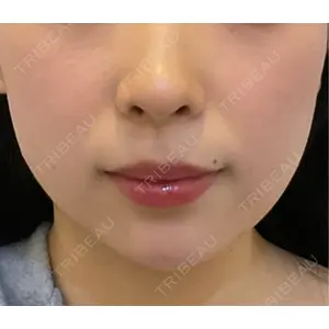 ルラ美容クリニック ルラ美容クリニック 渋谷本院口コミ