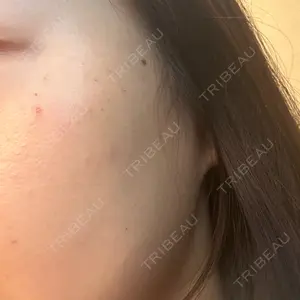 BITO BEAUTY CLINIC BITO BEAUTY CLINIC口コミ