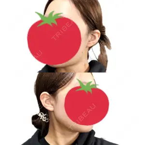 東京ココセランクリニック口コミ