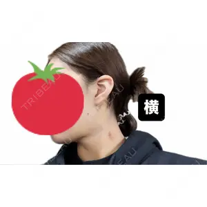 東京ココセランクリニック口コミ