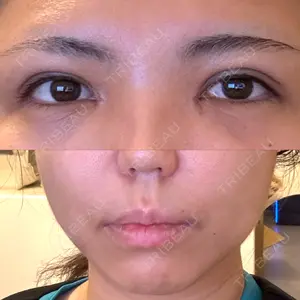 東京シンデレラ美容外科 東京シンデレラ美容外科 池袋院口コミ