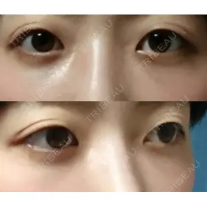 韓国ST美容整形外科口コミ