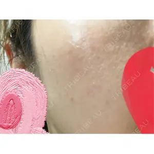 おおかみ美容のクリニック おおかみ美容のクリニック 新宿院口コミ