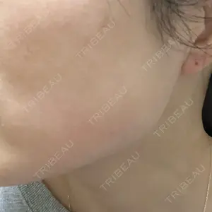 やさしい美容皮膚科・皮フ科 やさしい美容皮膚科・皮フ科　秋葉原院口コミ
