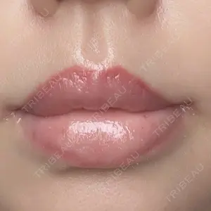 ルーチェクリニック ルーチェクリニック 銀座院口コミ