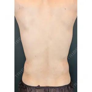 脂肪吸引の森クリニック 脂肪吸引の森クリニック東京院口コミ