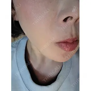 REDLINE CLINIC口コミ