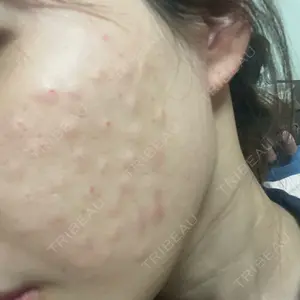 サラン鶴橋皮フ科の口コミ