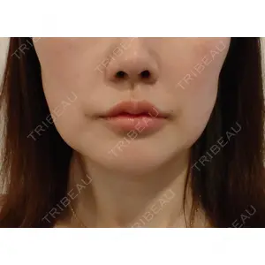 THE CLINIC THE CLINIC（ザ・クリニック） 大阪院口コミ