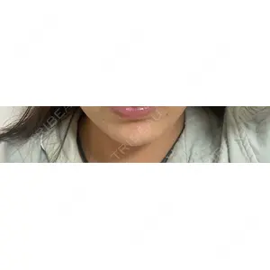 HAAB×DREAM BEAUTY CLINIC HAAB×DREAM BEAUTY CLINIC 大阪梅田院口コミ