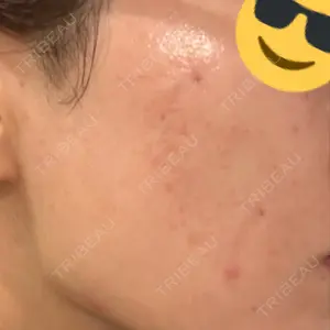 DAILY SKIN CLINIC DAILY SKIN CLINIC 福岡院口コミ