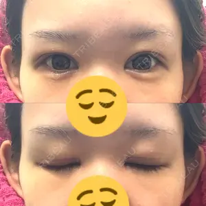 アリエル美容クリニック アリエル美容クリニック 水戸院口コミ