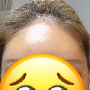 plume clinic plume clinic口コミ