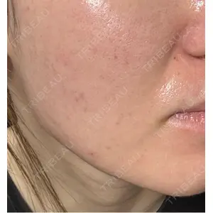 クレオビューティークリニック口コミ