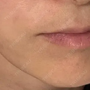 ルラ美容クリニック ルラ美容クリニック 渋谷本院口コミ