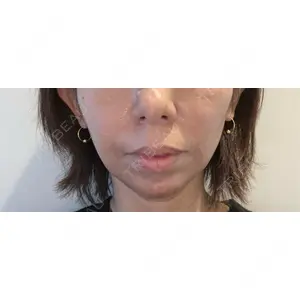 HAAB×DREAM BEAUTY CLINIC HAAB BEAUTY CLINIC 名古屋院口コミ