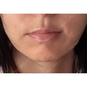 ルラ美容クリニック ルラ美容クリニック 渋谷本院口コミ