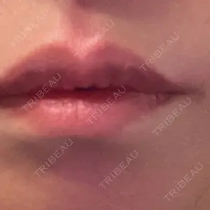 NARU Beauty Clinic NARU Beauty Clinic 【ナルクリ】口コミ