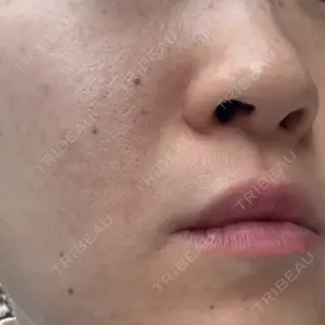 東京美容外科 東京美容外科 銀座院口コミ