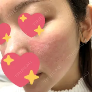 Natural Skin Clinic Natural Skin Clinic 笹塚院口コミ