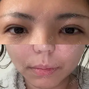 東京シンデレラ美容外科 東京シンデレラ美容外科 池袋院口コミ