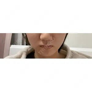 Natural Skin Clinic Natural Skin Clinic 笹塚院口コミ