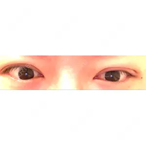 東京ココセランクリニック口コミ