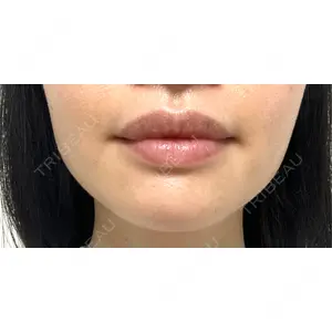 TCB東京中央美容外科 TCB東京中央美容外科 自由が丘院口コミ