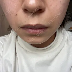 おおかみ美容のクリニック おおかみ美容のクリニック 新宿院口コミ