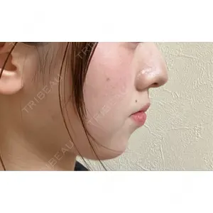 HAAB×DREAM BEAUTY CLINIC HAAB BEAUTY CLINIC 名古屋院口コミ