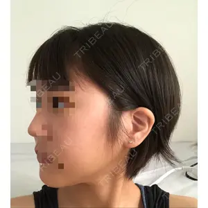id美容外科の口コミ