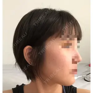 id美容外科の口コミ