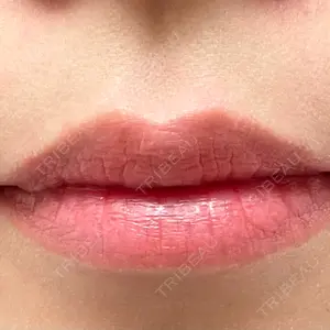 L‘amour clinic Tokyo【ラムールクリニック東京】口コミ