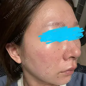 ルラ美容クリニック ルラ美容クリニック 名古屋栄院 / ルラスキンクリニック 名古屋栄院口コミ