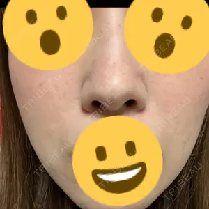 ゆきスキンクリニック 東池袋口コミ