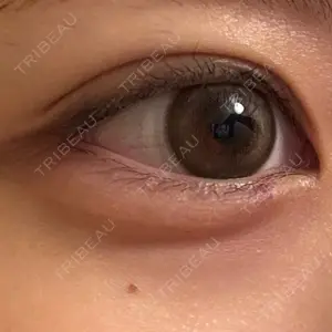 ルラ美容クリニック ルラ美容クリニック 仙台院 / ルラスキンクリニック 仙台院口コミ